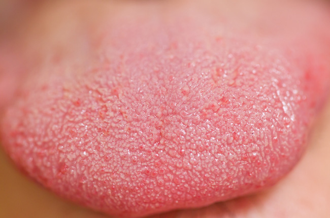 Detailed close up of a tongue.